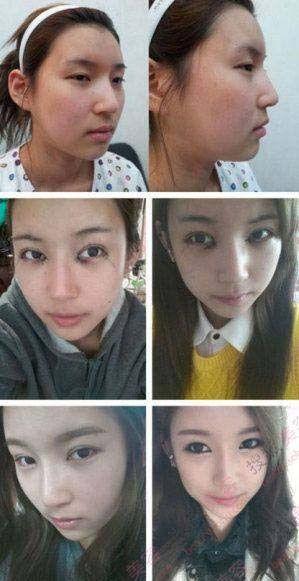 韩国整容医生爆料视频,揭秘整形手术背后的真相